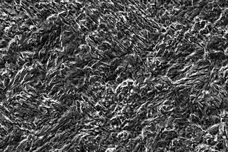 Martensitic Stainless Steel Microstructure-1